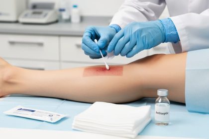 Gloved clinician hands holding a sterile swab over a cleaned wound dressing area in a clinical setting, with antiseptic gauze and swab materials nearby.